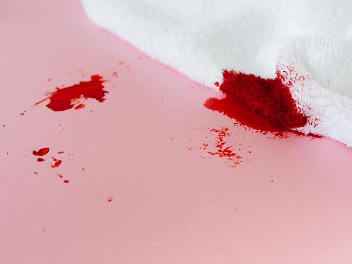 Red tannin stain on a white towel from the stain removal chart